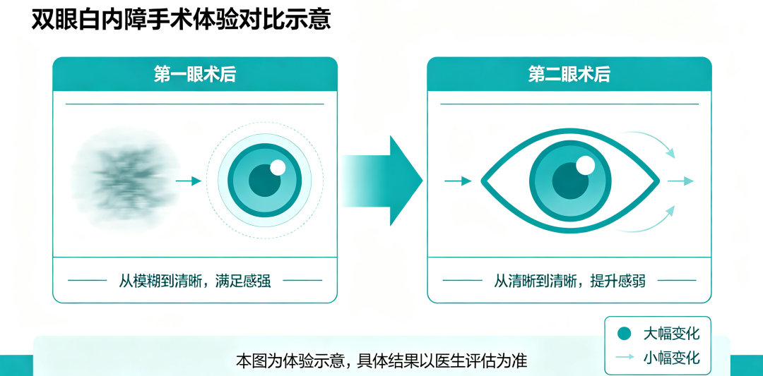 双眼白内障手术，第二只眼更疼更怕？真相没那么可怕