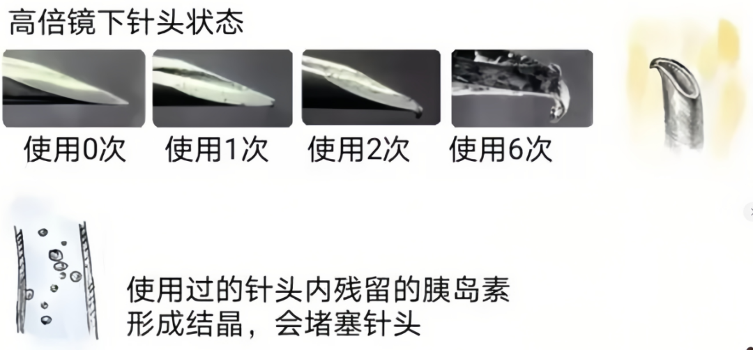 胰岛素注射的六个细节,很多糖尿病患者都做错了
