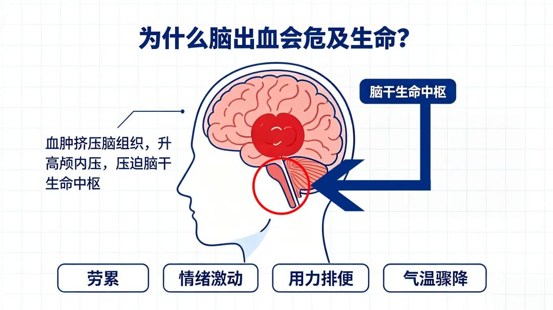 健康科普丨警惕脑出血!读懂预警信号,学会关键急救