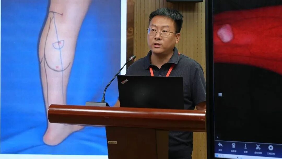 国家卫健委显微技能提升项目落地徐州仁慈医院,全国高水平专家汇聚彭城共话创新