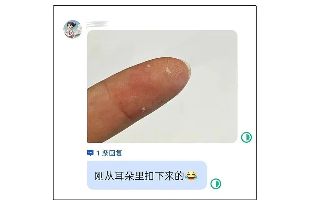 耳朵一圈为啥总有黄色油垢,刮一下能有满满一指甲?