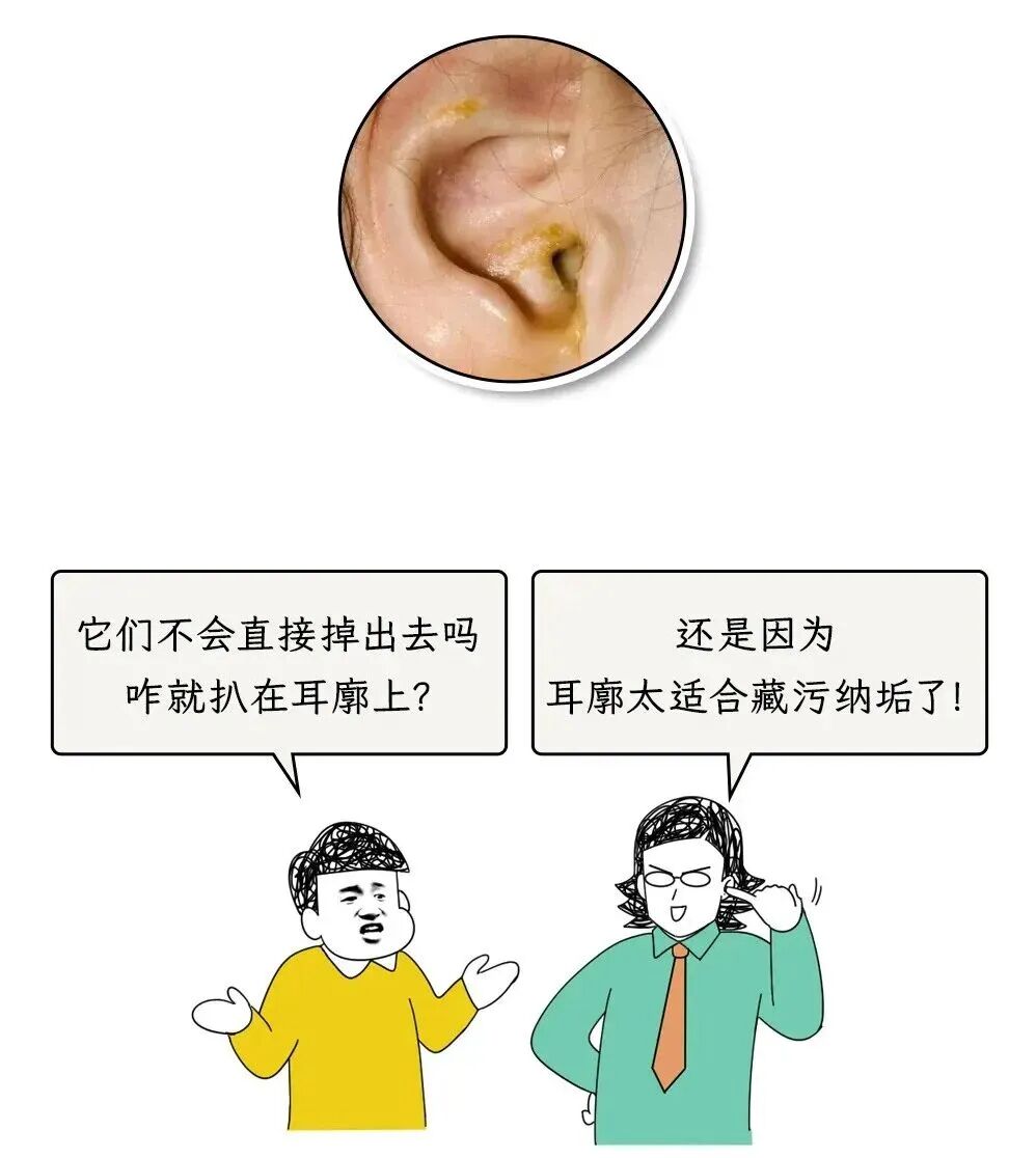 耳朵一圈为啥总有黄色油垢,刮一下能有满满一指甲?