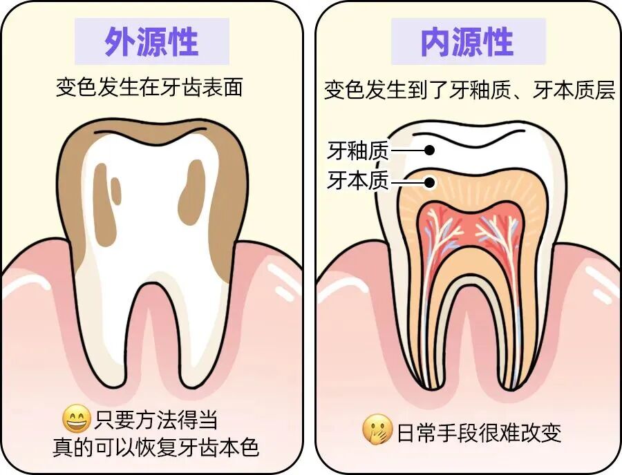 明明每天刷牙,为什么你还是"黄牙星人"→