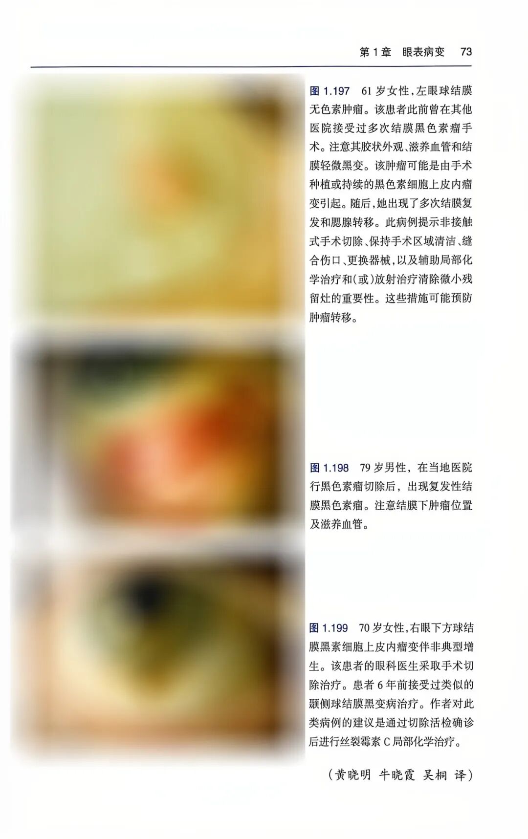 共享全球眼科智慧 | 孙丰源院长主审《临床眼肿瘤图谱》中文译版出版