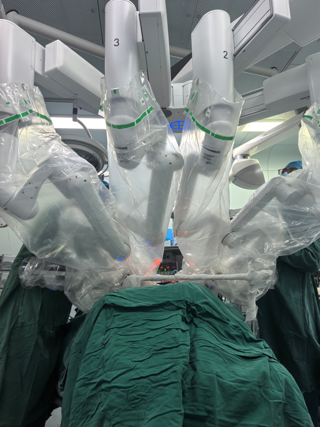 “颈”益求精：我院甲状腺外科完成第100例机器人甲状腺手术