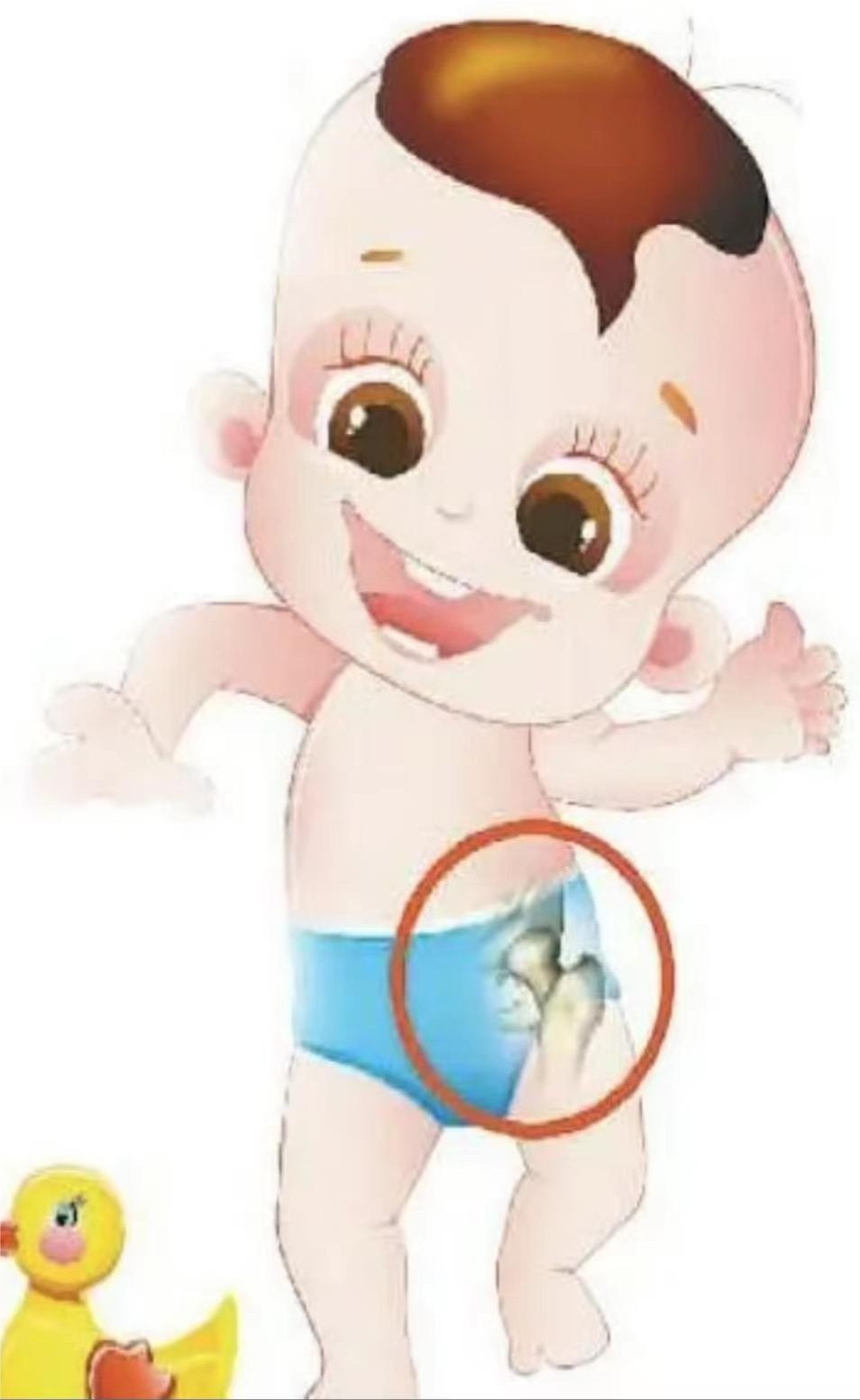 宝宝为什么要做髋关节超声检查？