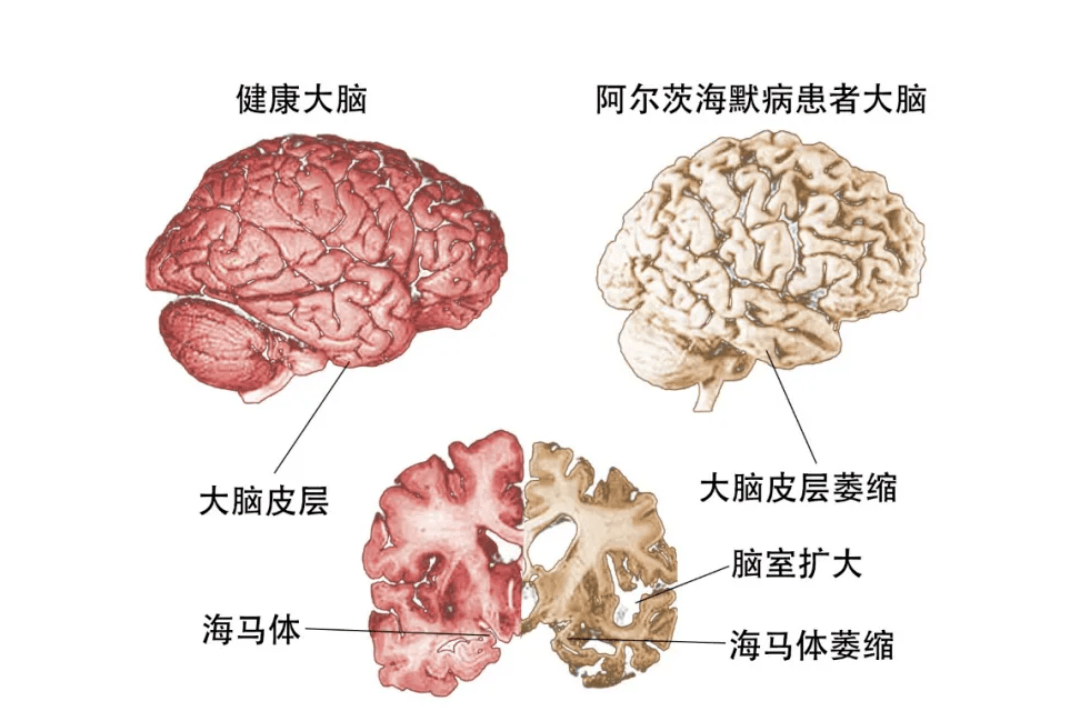 怀疑儿媳偷东西?婆媳彻底闹僵,根源竟是......