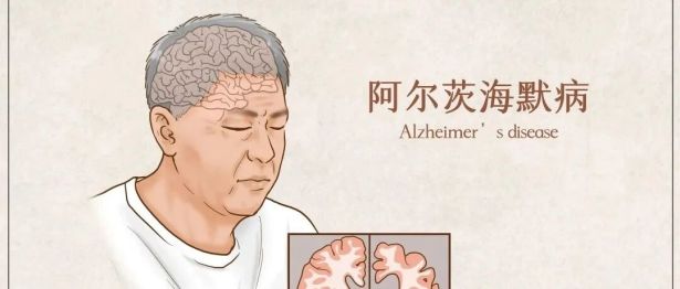 【世界阿尔茨海默病日】1000万人患有痴呆症？有些“记性差”真不是老糊涂那么简单