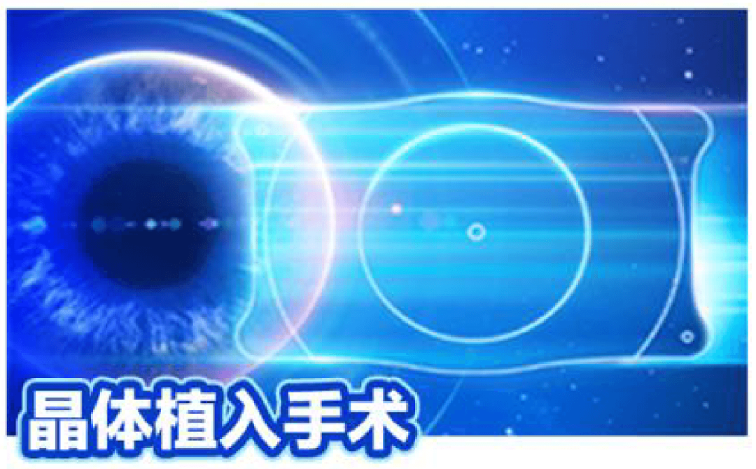 想摘镜,不能做全飞秒怎么办?