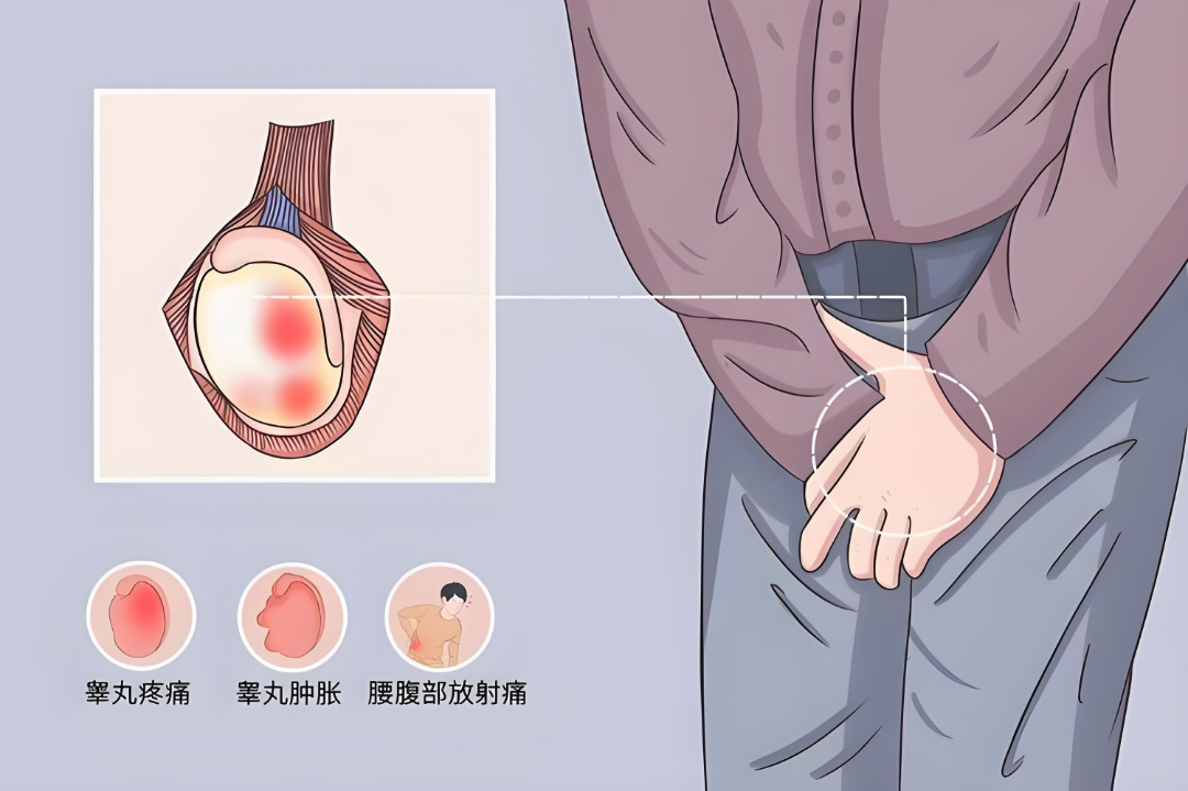关于睾丸扭转,每个男性都该知道的6小时