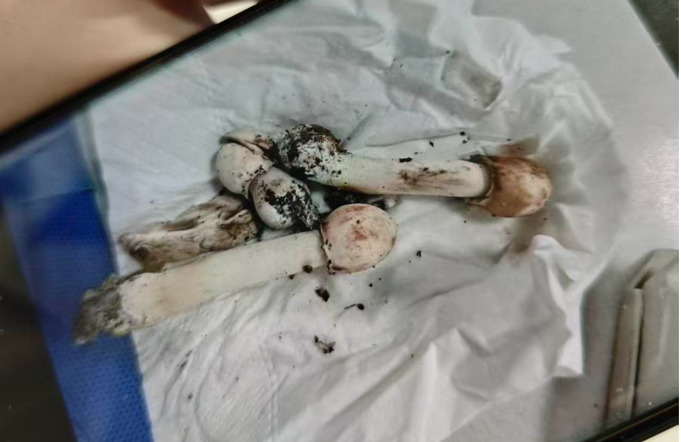 院子长出野蘑菇,晚餐尝鲜下肚……中毒了!