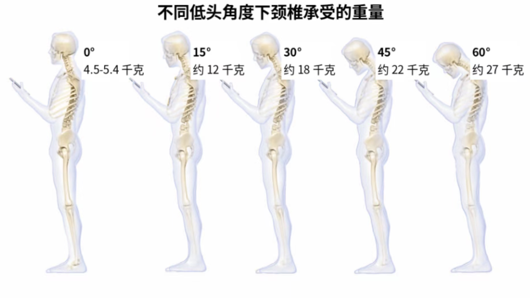 中秋赏月多抬头，给颈椎放个假（附3个护颈小妙招）