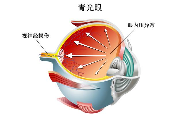 微信图片_20220723140508.png 眼压到底是个啥?一篇文章搞清楚