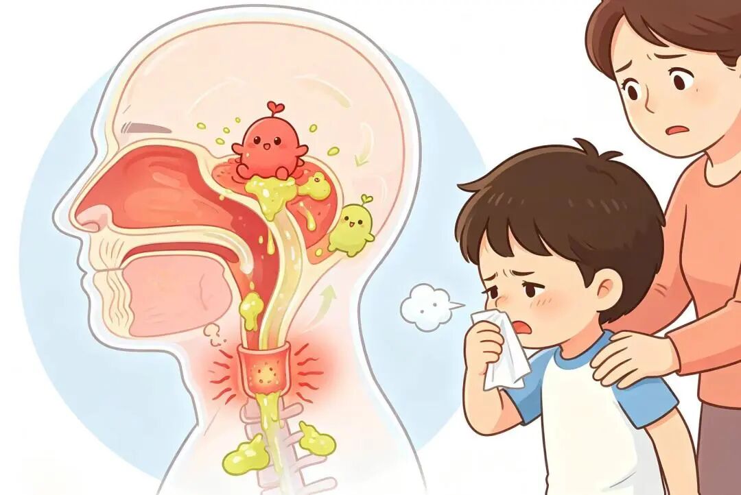 【科普】孩子咳嗽老不好？病根可能藏在鼻子里