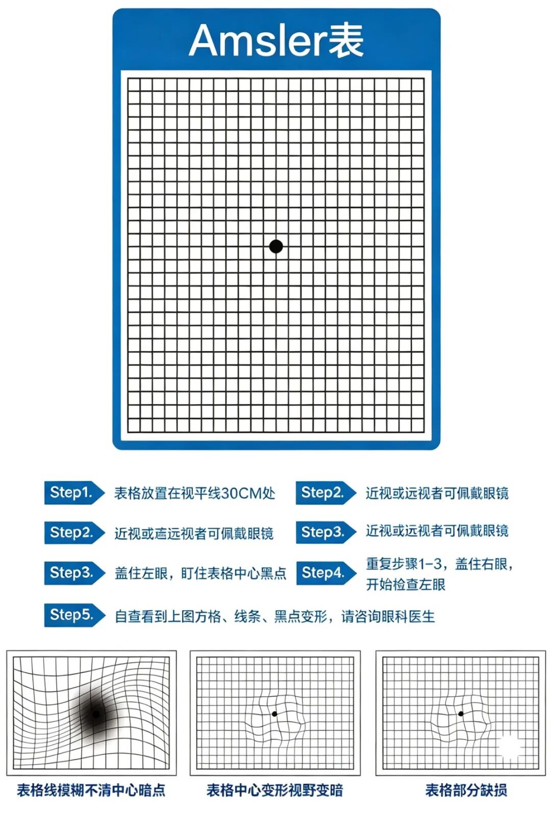 看直线变弯、看人脸变形？你的黄斑可能出问题了