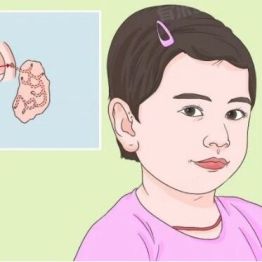 耳朵上的小洞洞，到底是个啥？