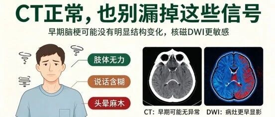 脑中风筛查为什么首选头颅核磁？DWI序列的救命价值