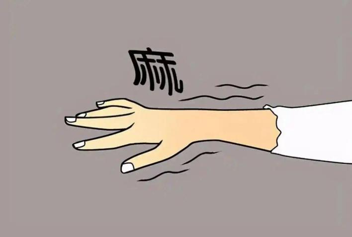手麻就是颈椎病?别再傻傻硬扛!一周麻木拖出急性脑梗死