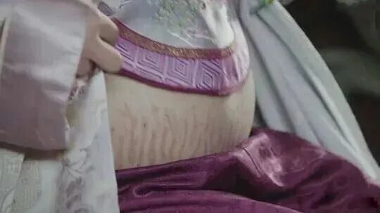 6种人易长妊娠纹,且年龄小反而易长!