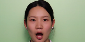 矫治第一步:为什么医生让我家孩子先练唇肌?