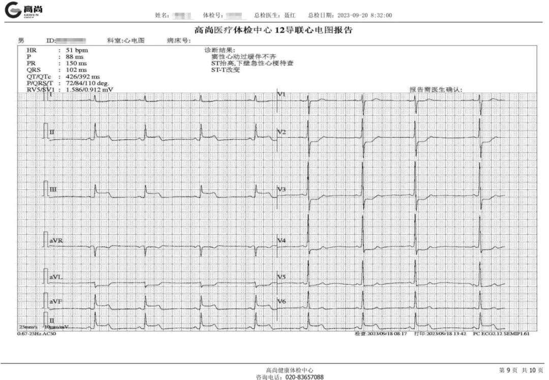 肠胃不舒服,多留个“心”眼:有可能是心梗