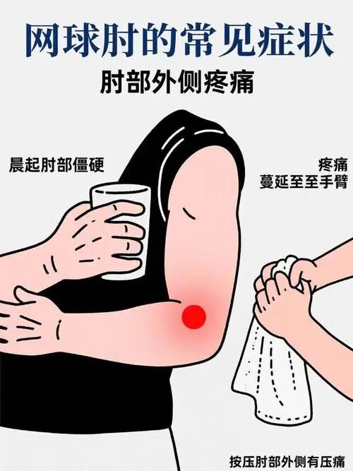 手肘一用力就疼?这些人要小心