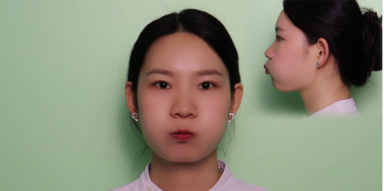 矫治第一步:为什么医生让我家孩子先练唇肌?