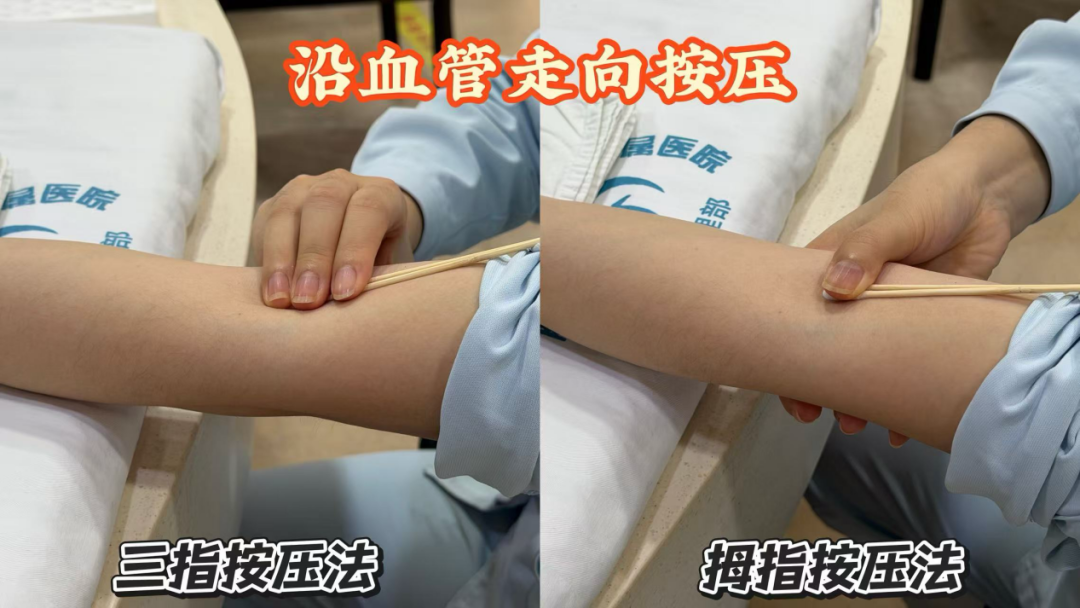 抽血完手臂淤青?原来是按压出了错