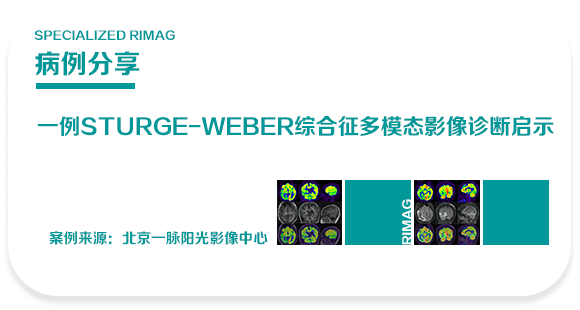 典型病例 | 脸上的“红胎记”,为什么要查大脑?