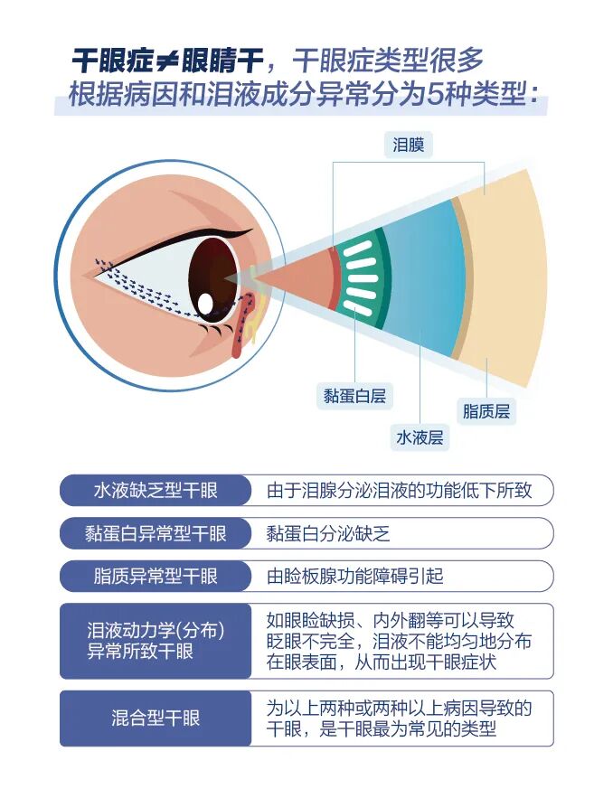 为什么眼药水越滴眼睛越干?根源在于缺了它