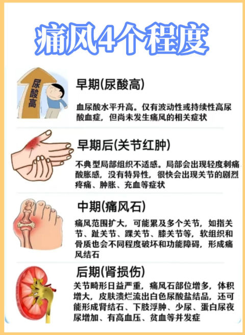 每天2杯甜饮料,痛风风险+85%? 你的“快乐水”正在悄悄伤关节