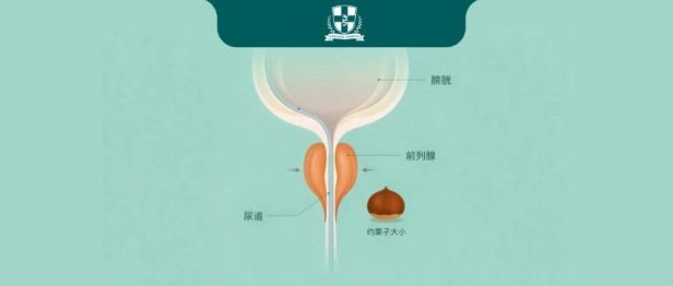 “越老越大”？60岁后每10个男人约6个被它困扰……