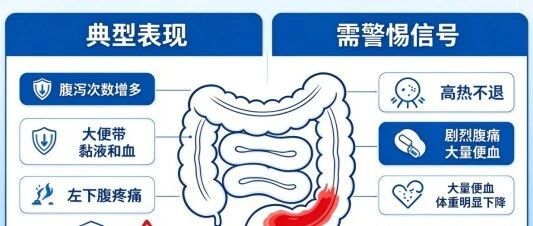 警惕黑便背后隐藏的肠道危机：溃疡性结肠炎