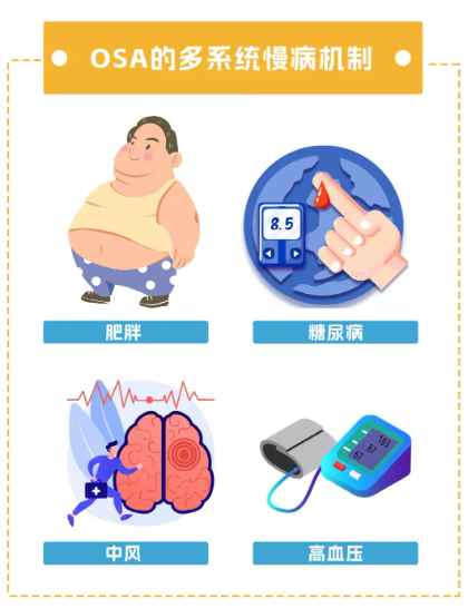 别再嫌他打呼噜吵了,也许他正睡得危险