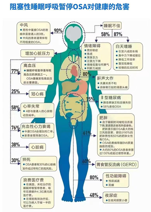 别再嫌他打呼噜吵了,也许他正睡得危险
