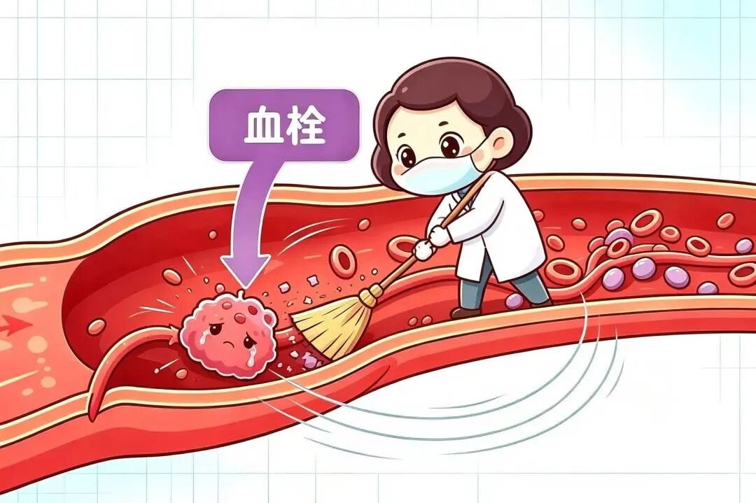 【科普】世界血栓日｜沉默的致命杀手，血栓榜上有名