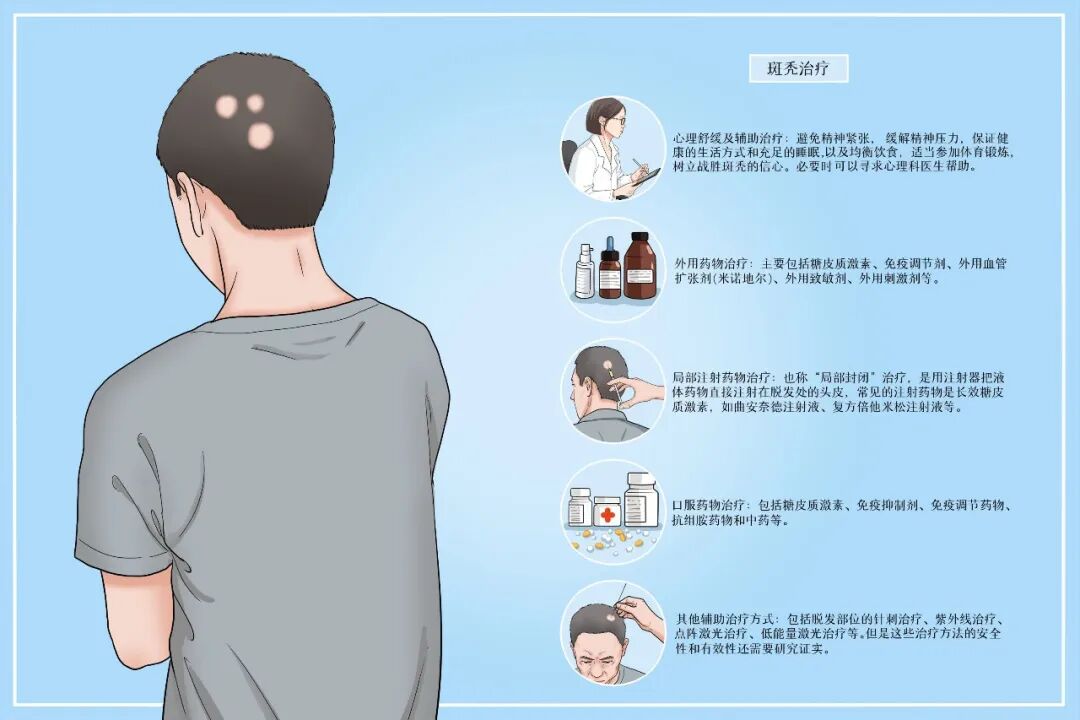 脱发高峰已到!看这里,稳住发量