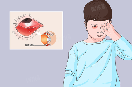 红眼≠就是红眼病!教你正确识别与防护