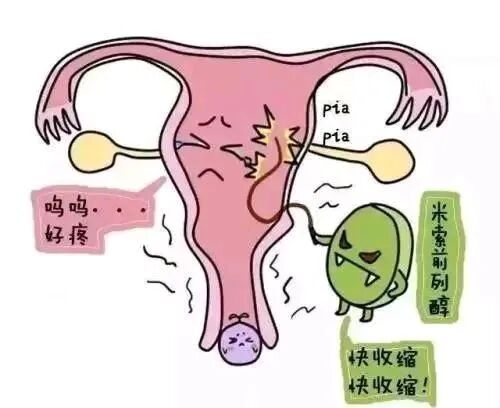 【二附院医生说】流产后的“不速之客”-妊娠胚胎残留物