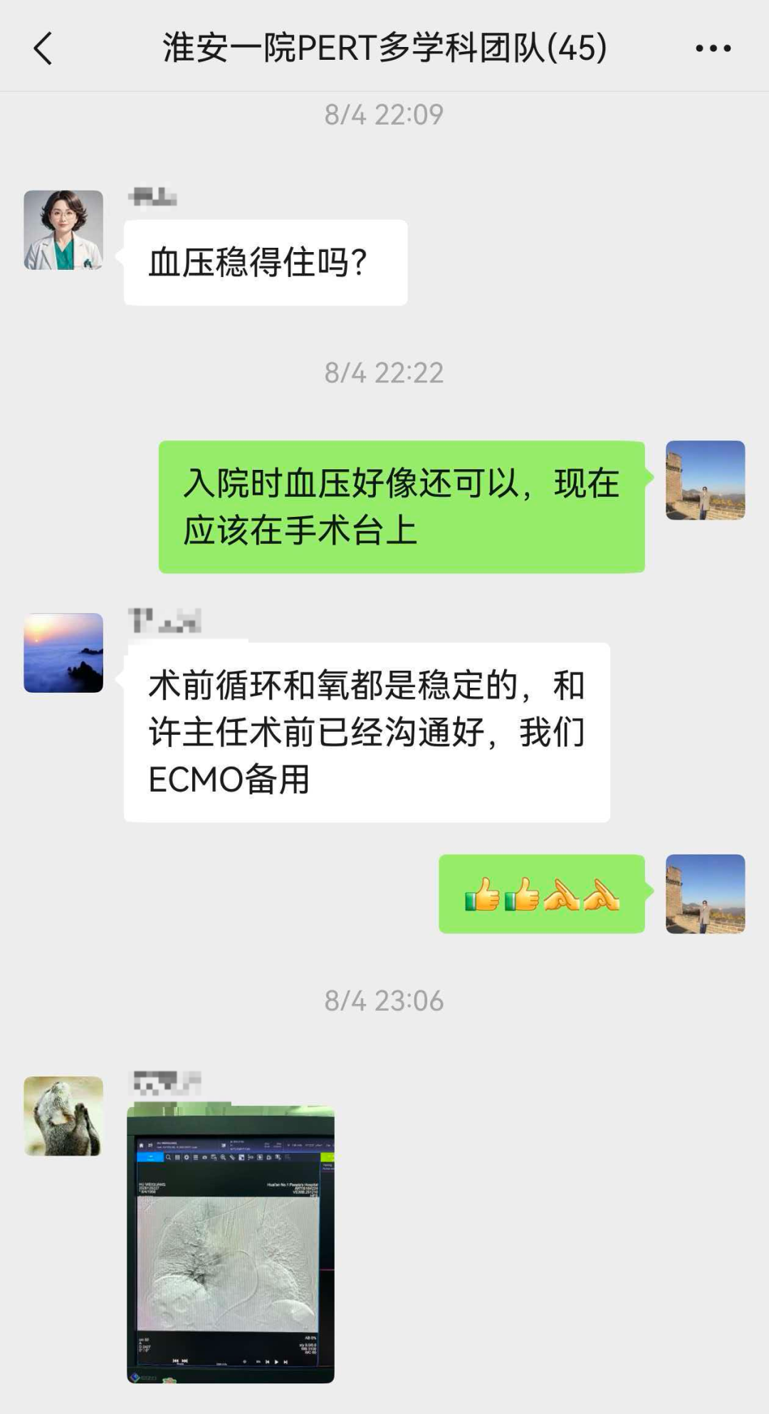 世界血栓日丨胸闷气促8天,心脏里竟藏致命血栓?淮安市一院急性肺栓塞多学科救治团队(PERT)接力两次取栓,生死营救9天