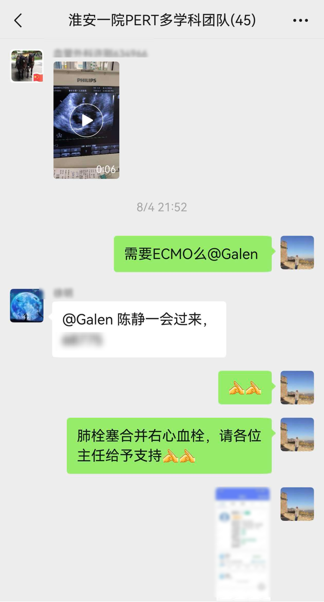 世界血栓日丨胸闷气促8天,心脏里竟藏致命血栓?淮安市一院急性肺栓塞多学科救治团队(PERT)接力两次取栓,生死营救9天