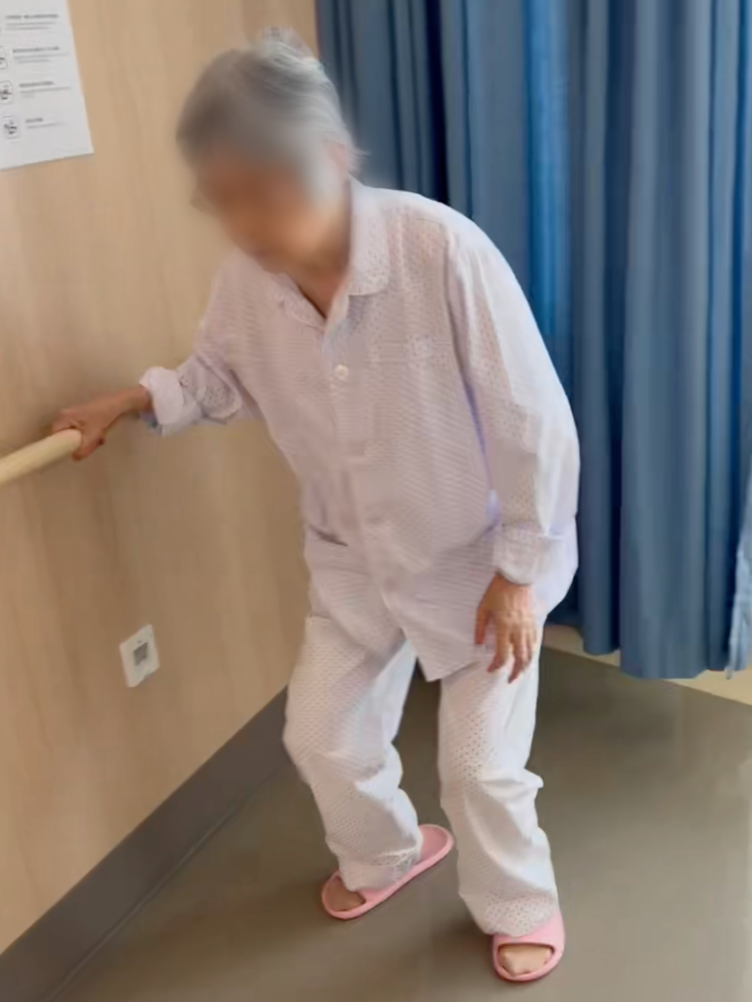 一位八旬高龄患者的髋关节「翻修记」