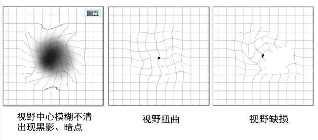看不清,真的是老花眼吗?丨重阳节,聊聊父母眼睛里的那些“隐形危机”