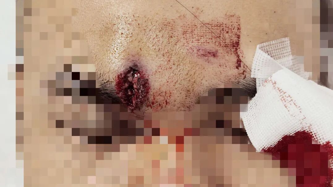 胆小慎入！00后小伙一个动作，反被一“枪”爆头……