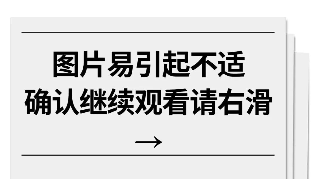 胆小慎入！00后小伙一个动作，反被一“枪”爆头……