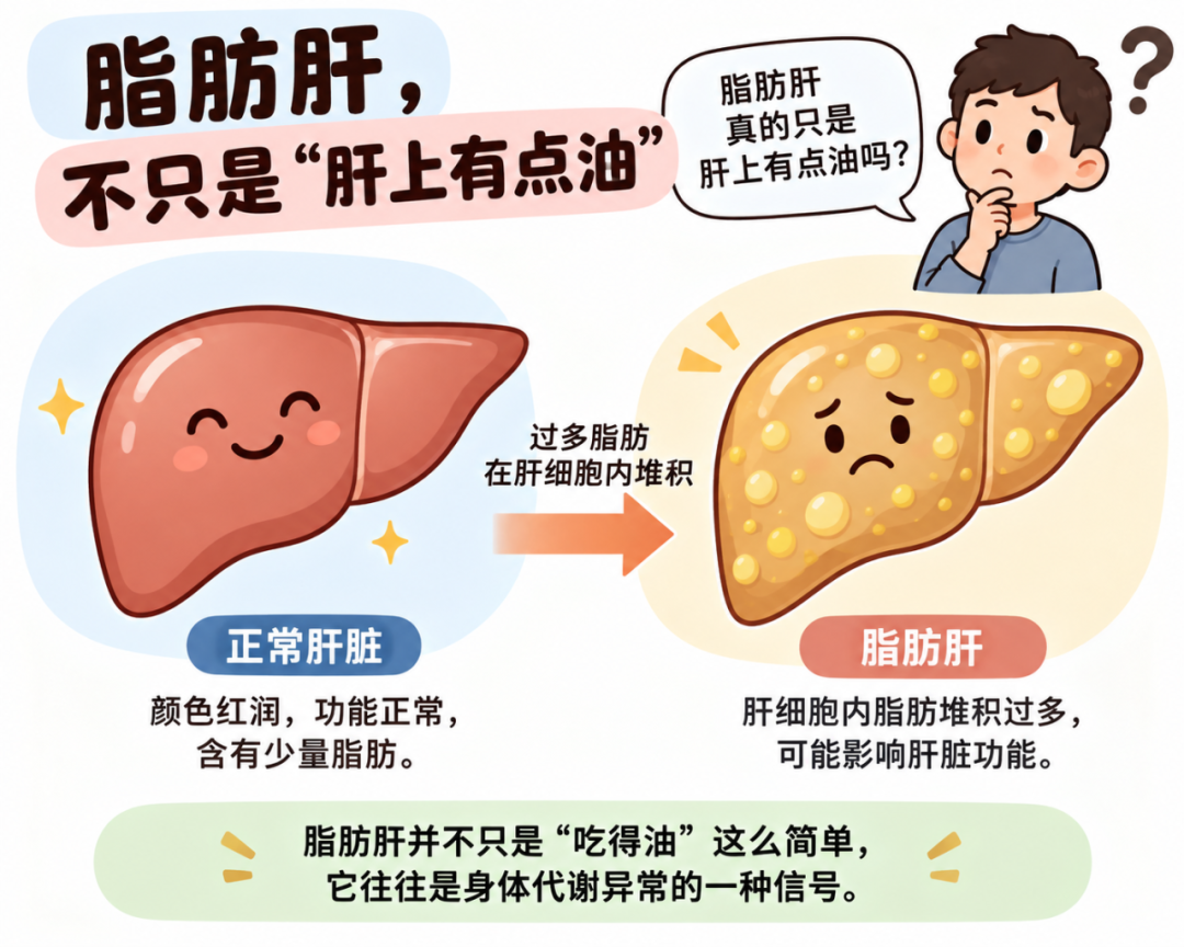 查出脂肪肝怎么办?从风险评估到生活方式管理,一文说清
