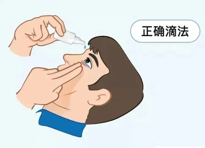 普瑞专家说|眼睛痒到想“抠出来”?换季高发的过敏性结膜炎,别再当“上火”治