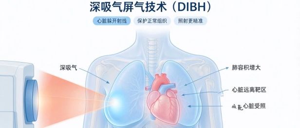 深呼吸 让乳腺癌放疗“不伤心”