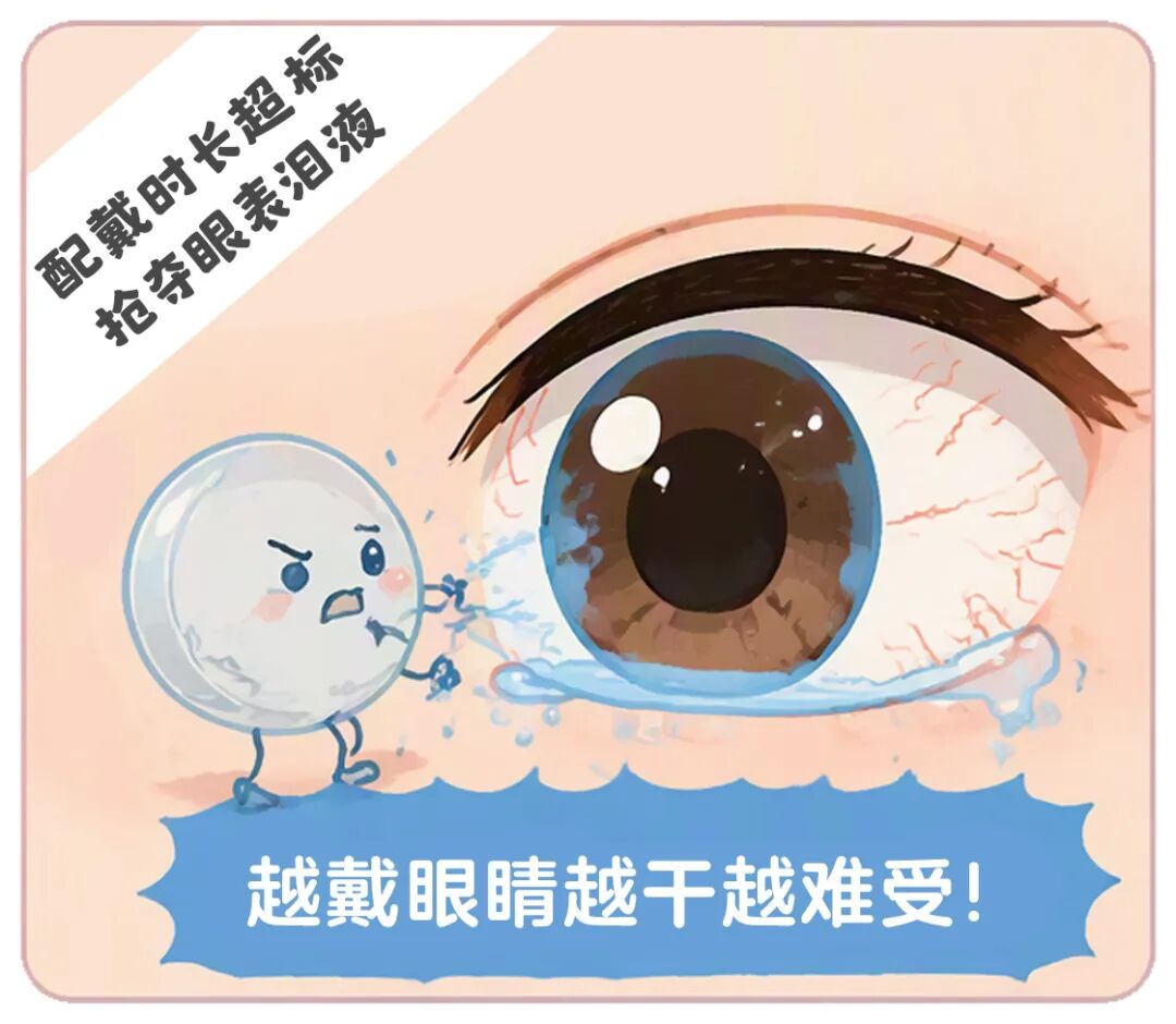 选错隐形眼镜,眼睛越戴越累?其实还有另一种选择