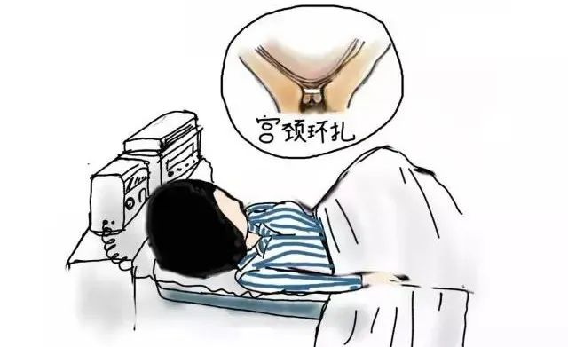 小小的环扎线,托起了她稳稳的幸福:我院产科助宫颈机能不全孕妈顺利分娩